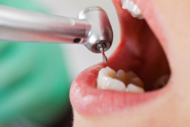 Best Pediatric Emergency Dentist in East Meadow, NY